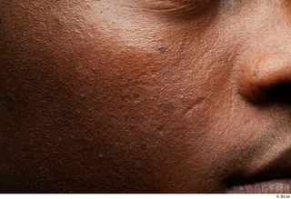 HD Face Skin Kavan cheek face scar skin pores skin…